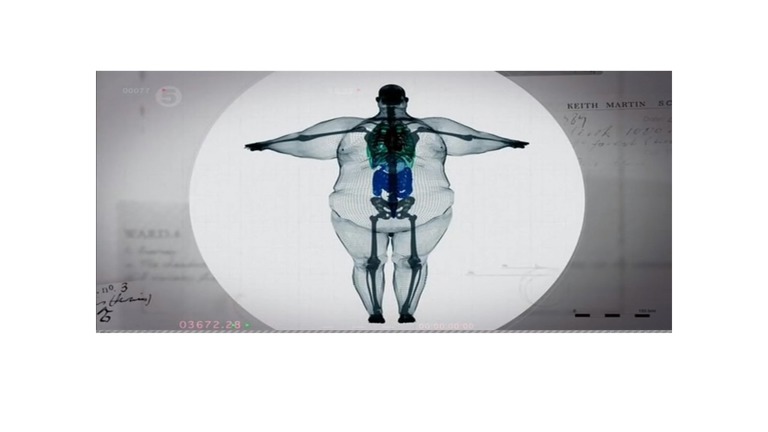 Lowest Cost Semaglutide  in your area