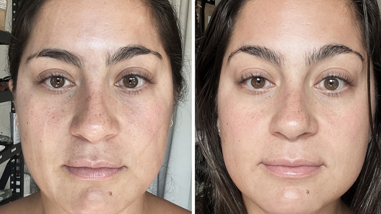 Before and After