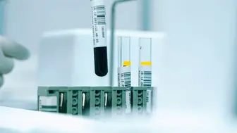 Mobile Drug Testing Service - High-Demand Healthcare Business