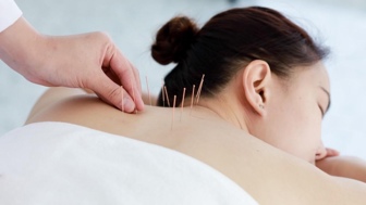 Acupuncture, massage, and fitness
