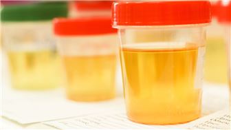Tox Lab in OC, with Good Equipment and In-network Contracts