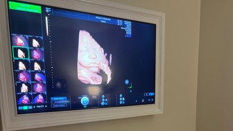 Premium 3D/4D ultrasound studio