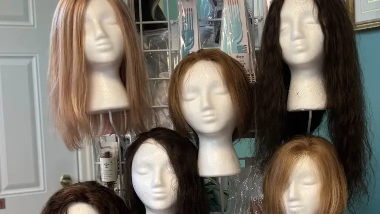 Non-Surgical Hair Loss Business