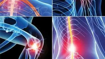 3 Non-Surgical Regenerative Pain Treatment Centers for Sale