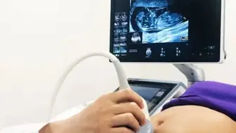 From Warsaw to Wall Street: AI-Integrated Ultrasound Built to Scale