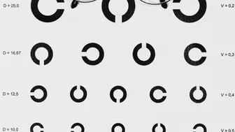 Medical Ophthalmology and Optical Sales